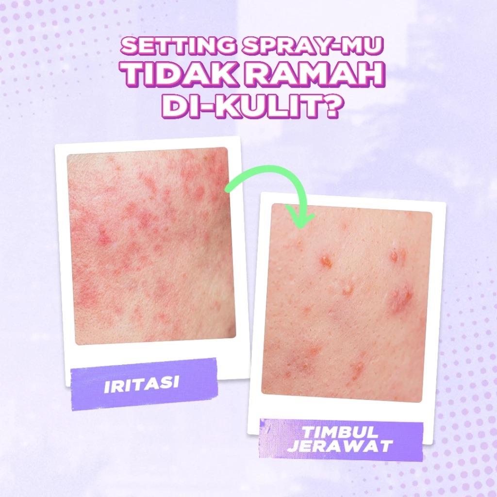 Dazzle Me Get a Grip! Makeup Setting Spray Acne Soothing 60ml (TOSCA)