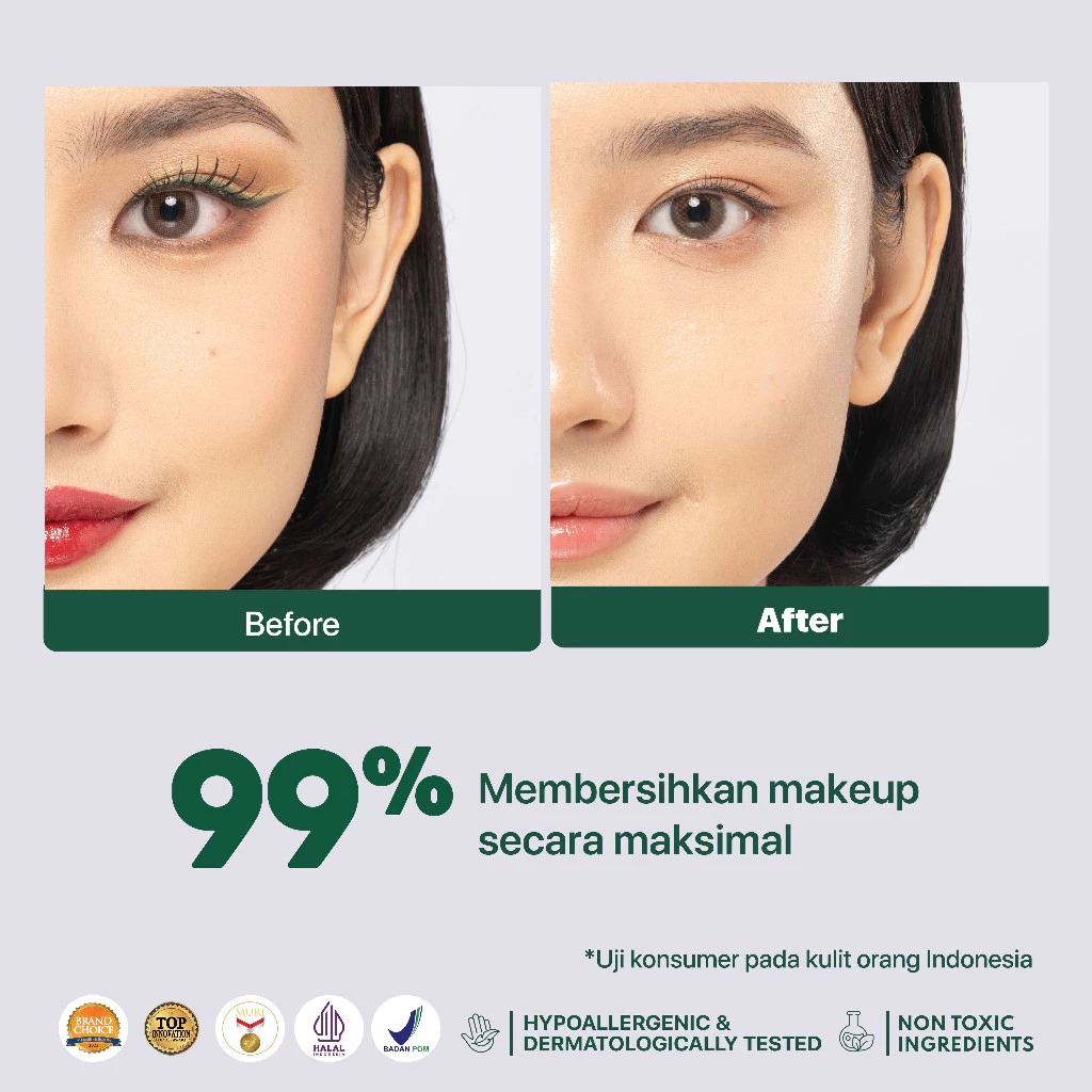 Npure Acne Power Clear Micellar Water 300ml