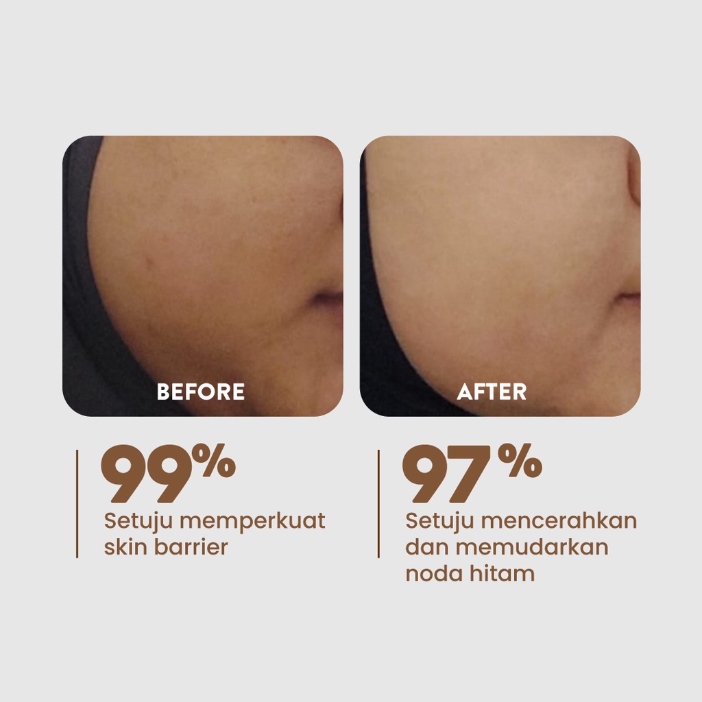 Npure Licorice Creamy Light Moisturizer 30gr