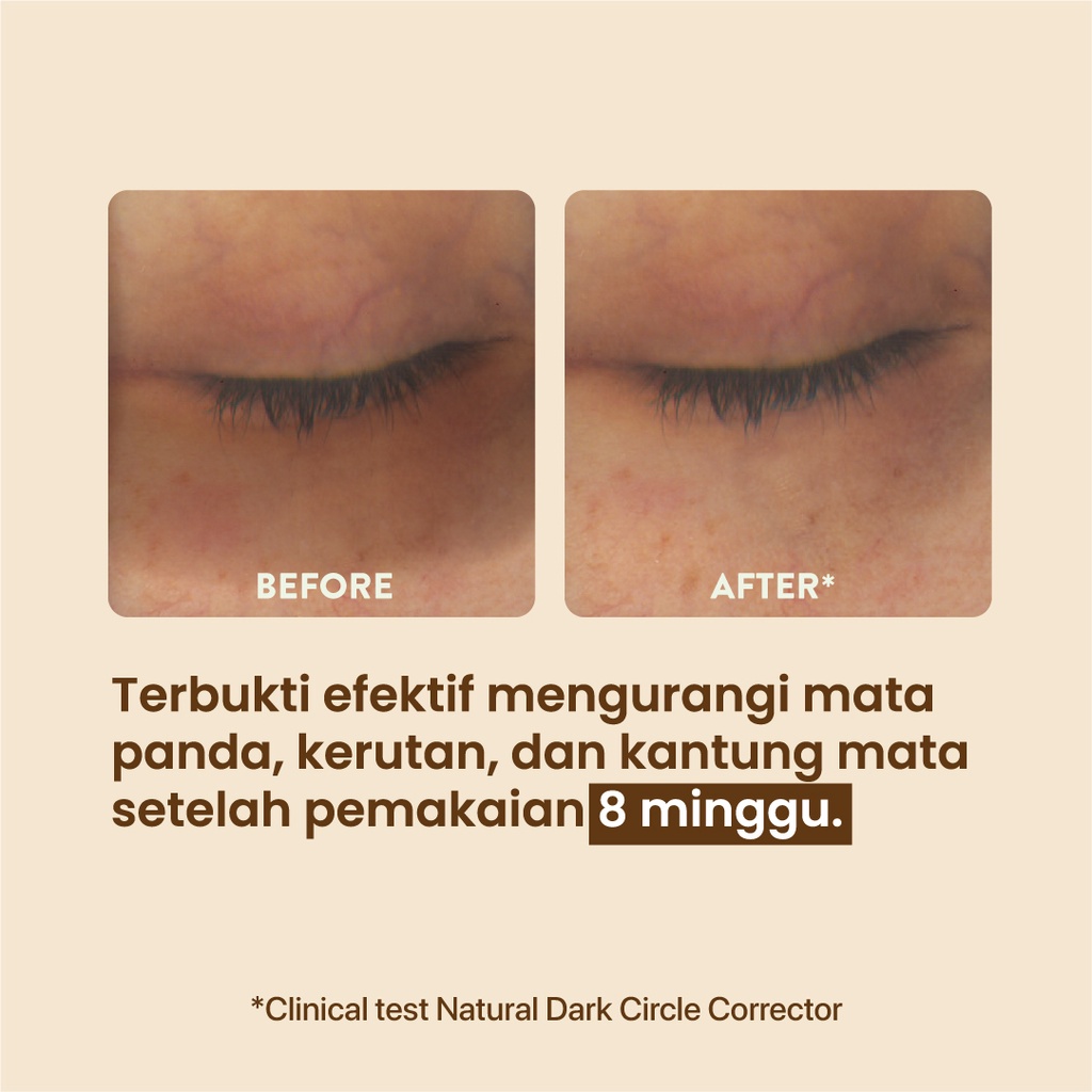 Npure Marigold Eyemazing Power Serum Concentrate 20ml