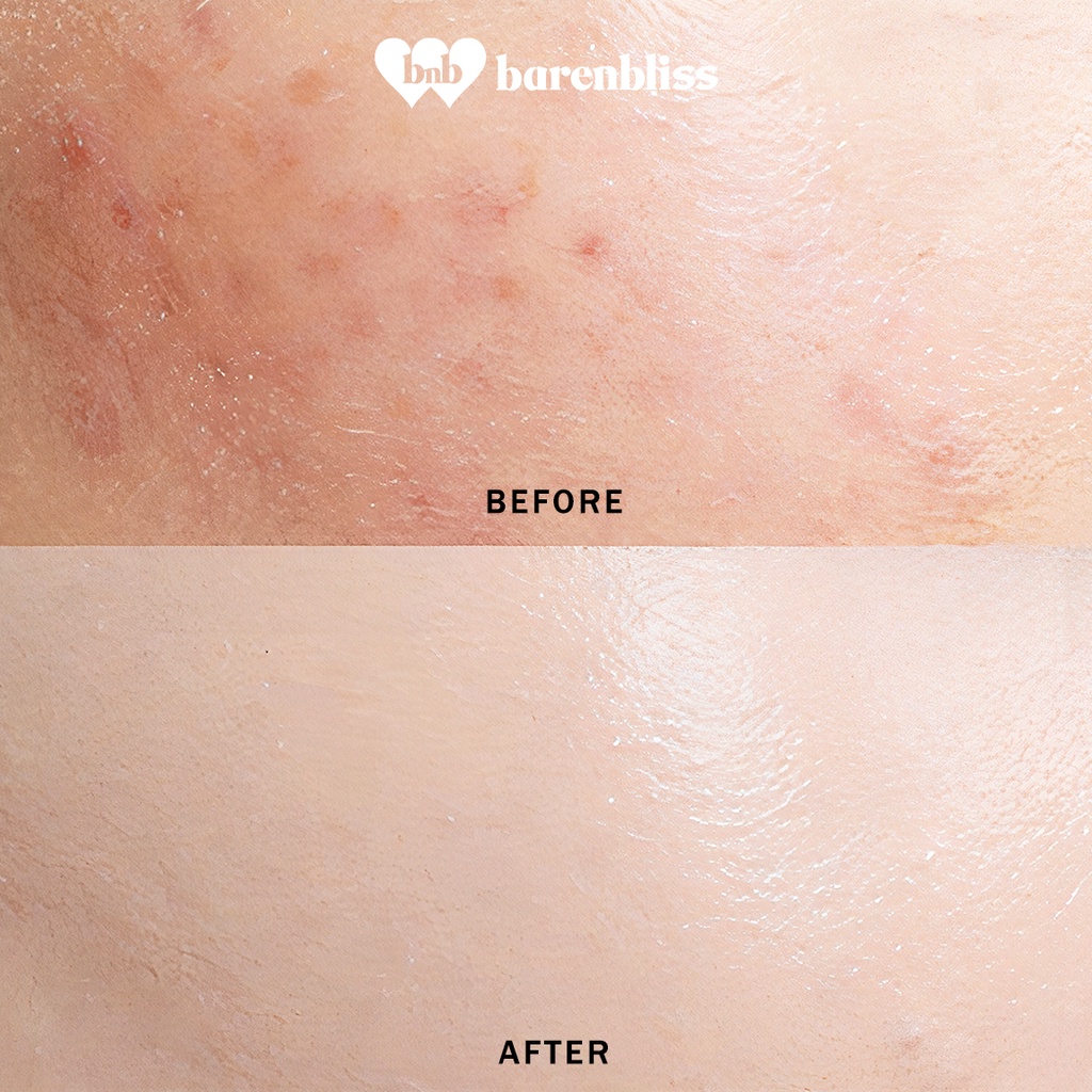 BNB Barenbliss Start Over Concealer - 02 Neutral Fresh Bud