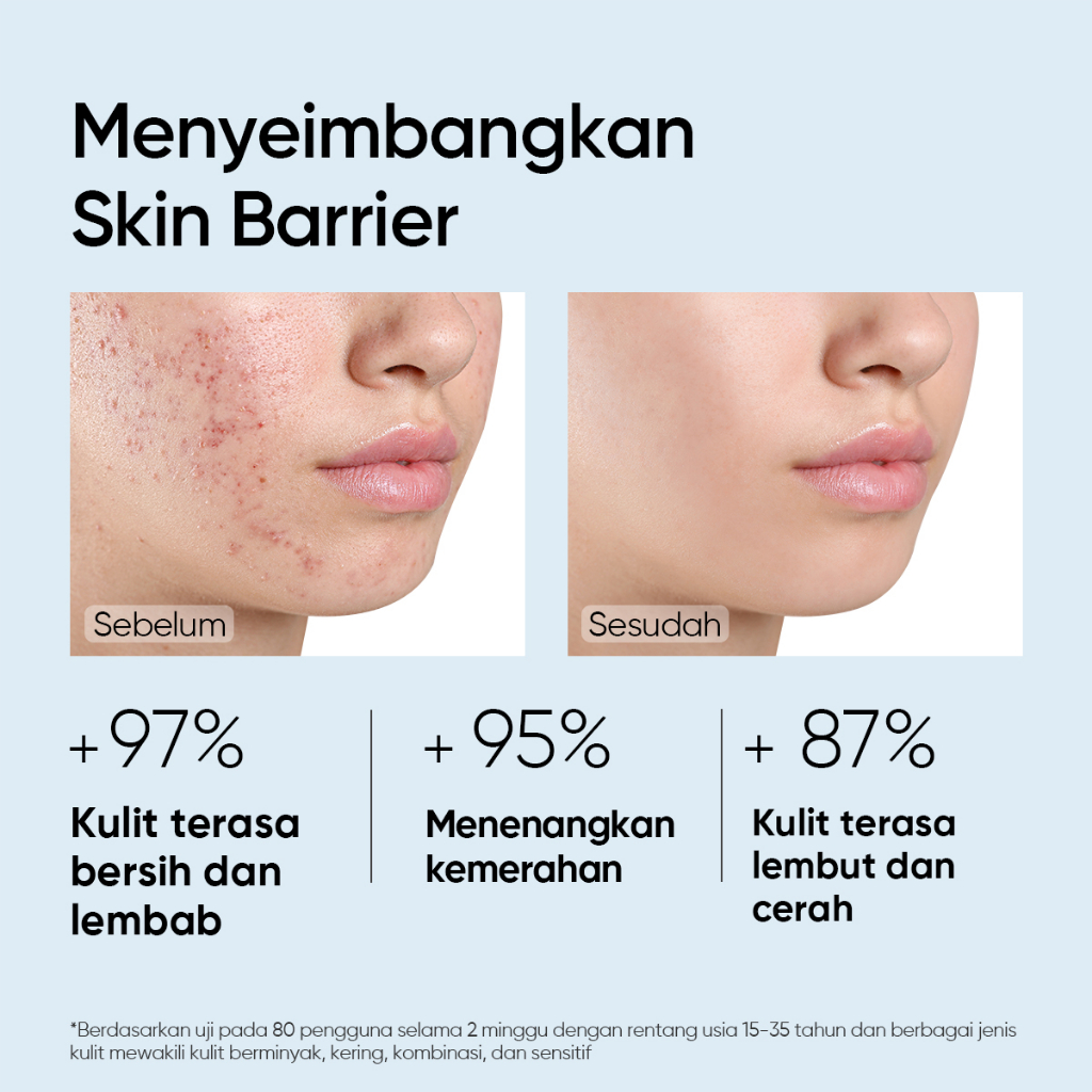 Skintific Amino Acid Ultra-Gentle Cleansing Mousse 100ml