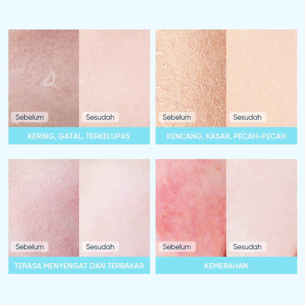 Skintific 5X Ceramide Soothing & Calming Sheet Mask 26ml Skintific 5X Ceramide Soothing & Calming Sheet Mask 26ml