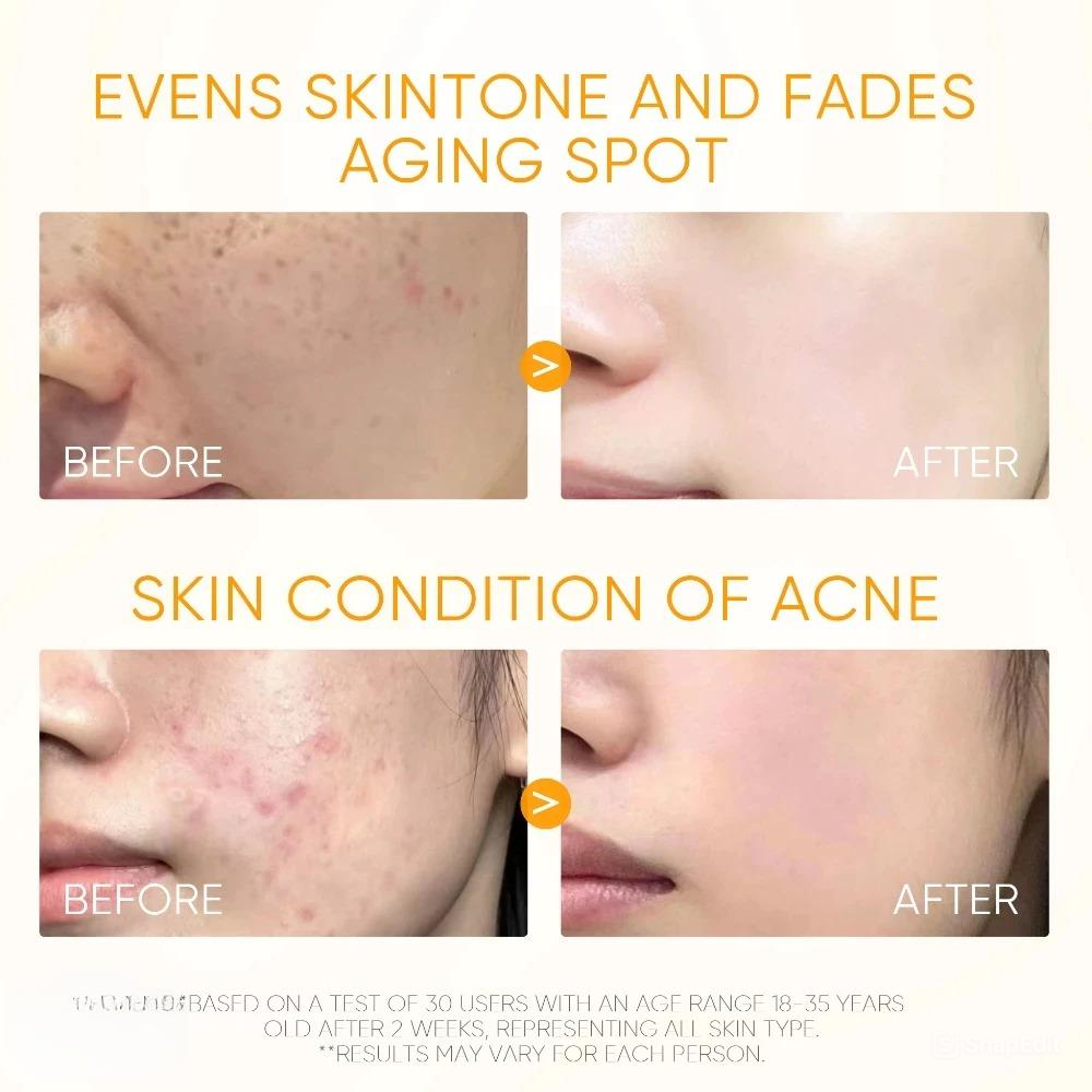 Skintific Potent Vitamin C Brightening Glow Serum 20ml