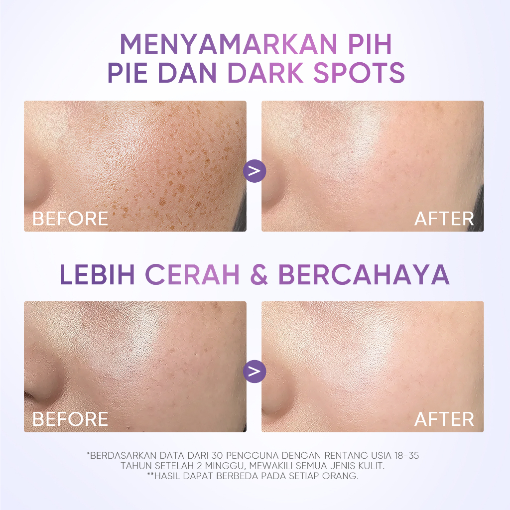 Skintific Symwhite377 Dark Spot Moisture Gel 30gr