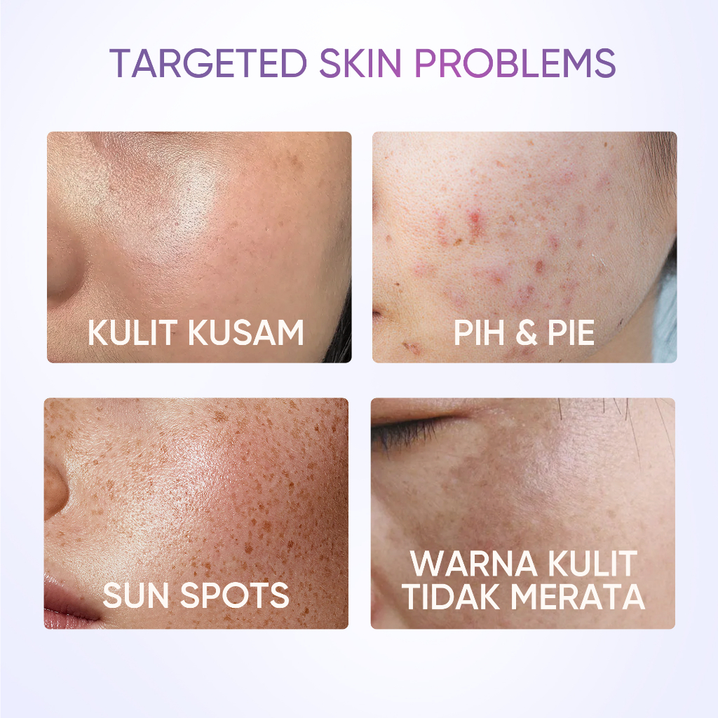 Skintific Symwhite377 Dark Spot Moisture Gel 30gr