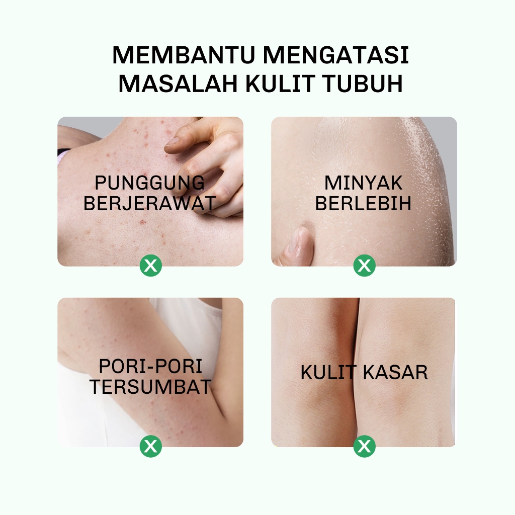 Lavojoy Solve It Now Improve Rough Skin Body Wash 300ml Lavojoy Solve It Now Improve Rough Skin Body Wash 300ml