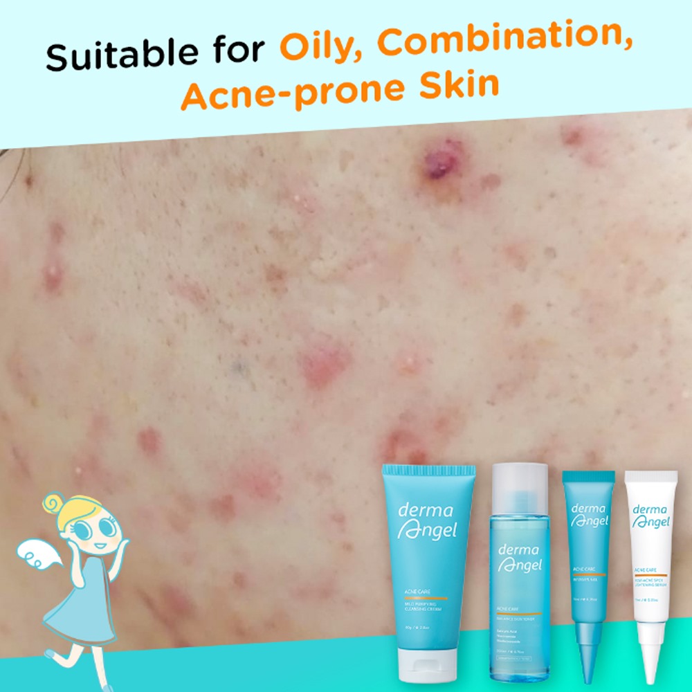 Derma Angel Acne Care Balance Skin Toner 200ml