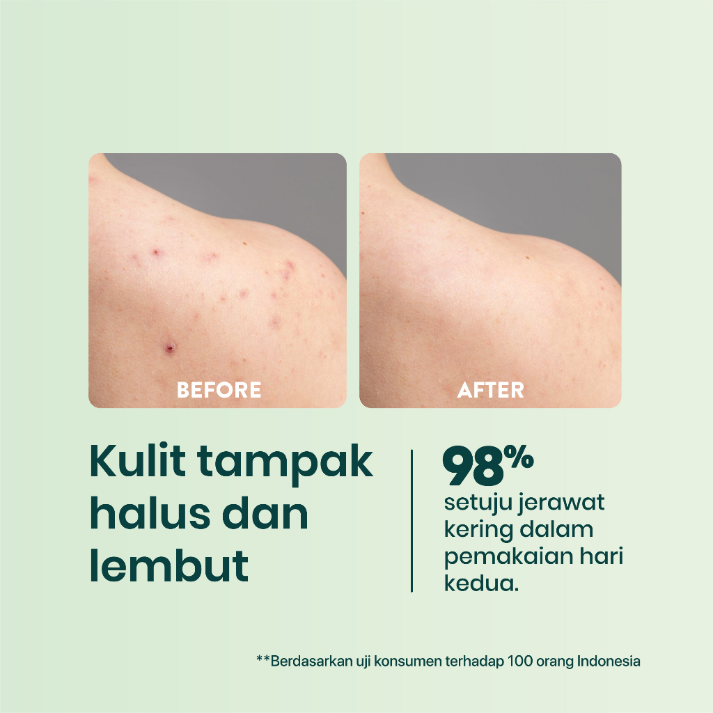 Npure Cica Bacne+ Acne Clear Body Spray 50ml