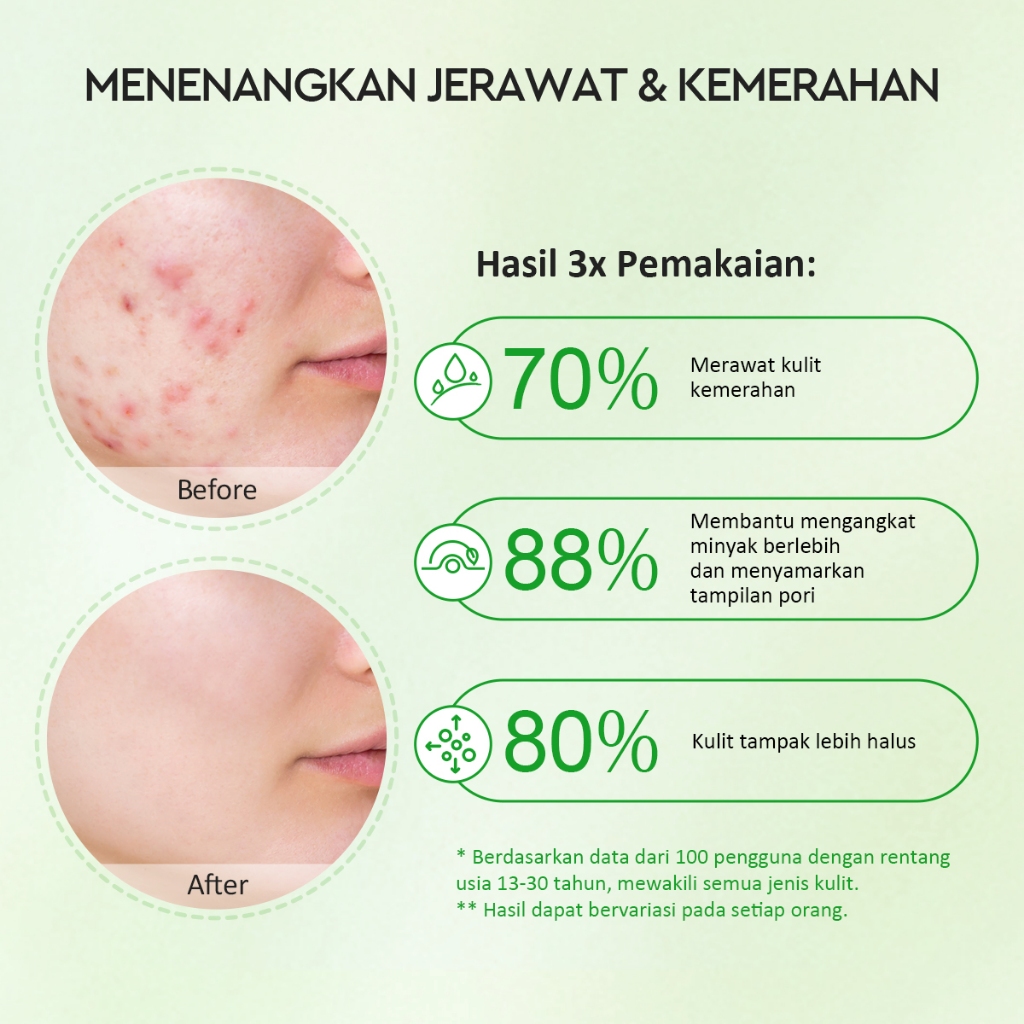 Glad 2 Glow Clay Stick - Mugwort Salicylic Acid Acne 25gr