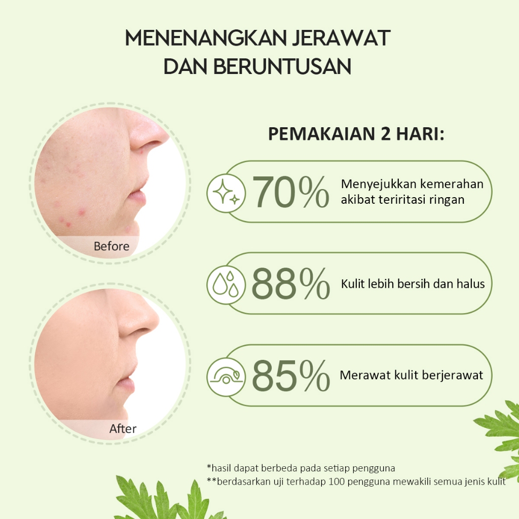 Glad 2 Glow Clay Mask - Mugwort Salicylic Acid Acne 30gr