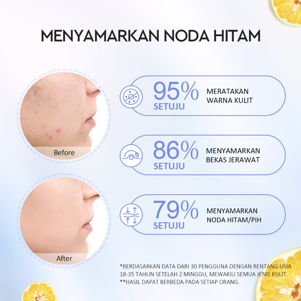 Glad 2 Glow Moisturizer - Yuja Symwhite 377 Dark Spot 30gr