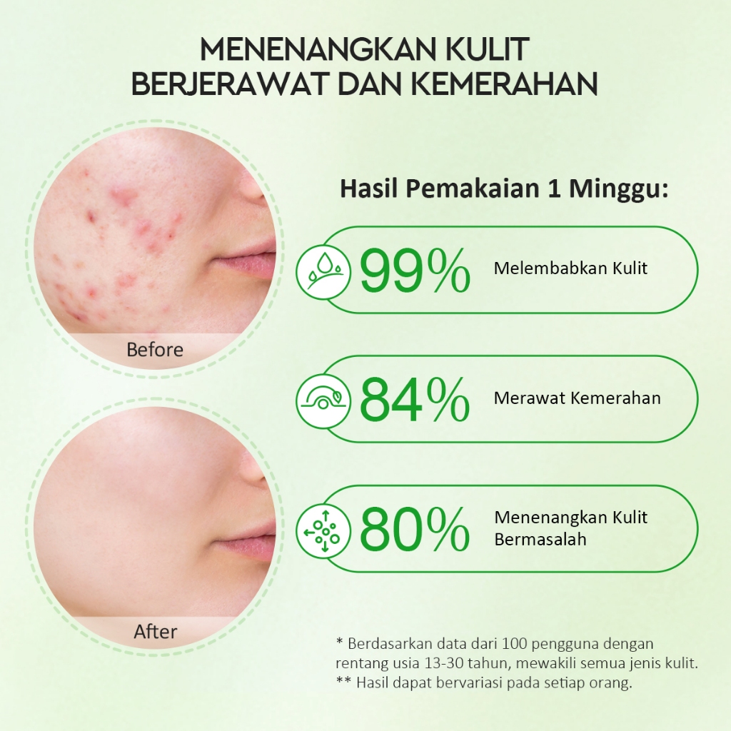 Glad 2 Glow Moisturizer - Centella Allantoin Soothing Gel 55gr