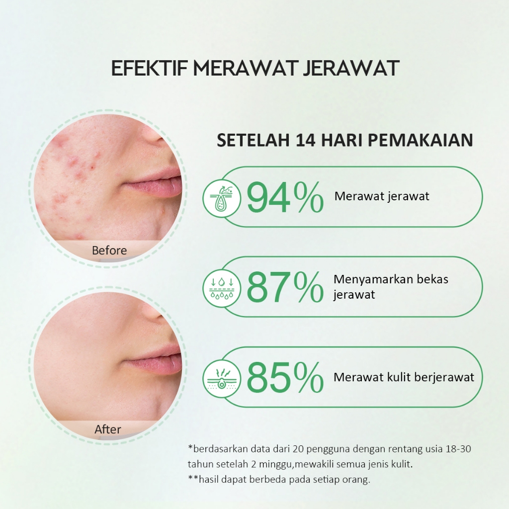 Glad 2 Glow Serum - Centella 2% Salicylic Acid Acne 17ml Glad 2 Glow Serum - Centella 2% Salicylic Acid Acne 17ml