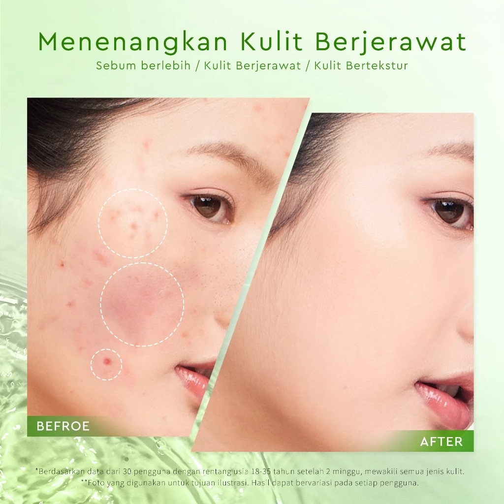 Glad 2 Glow Gel Mask - Pure Mugwort Acne 50gr