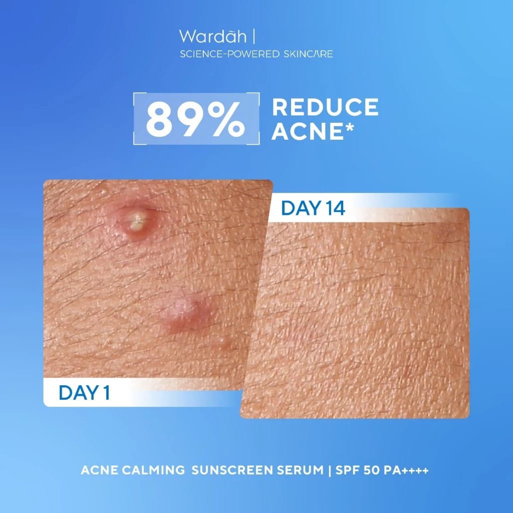 Wardah UV Shield Acne Calming Sunscreen Serum SPF50 PA++++ 25ml