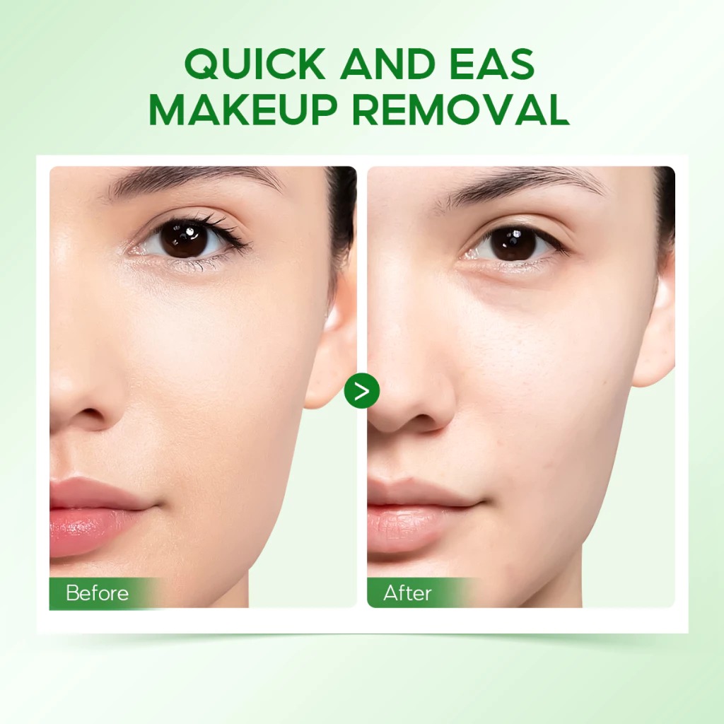 Sea Makeup Acne Butter Cleansing Balm 100gr