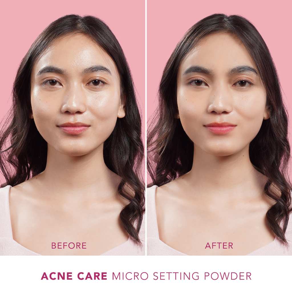 Sea Makeup Acne Care Micro Setting Powder 12gr - Translucent