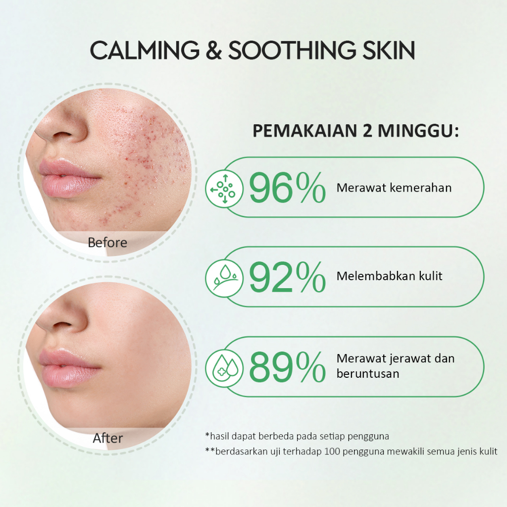 Glad 2 Glow Toner - 2% Centella Ceramide Soothing 80ml