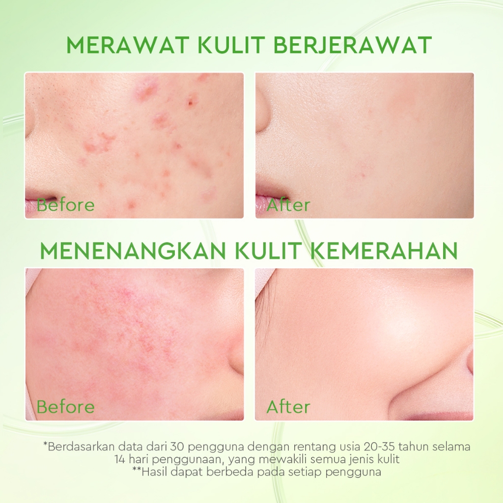Glad 2 Glow Moisturizer - Kiwi 3D Acid Acne 30gr