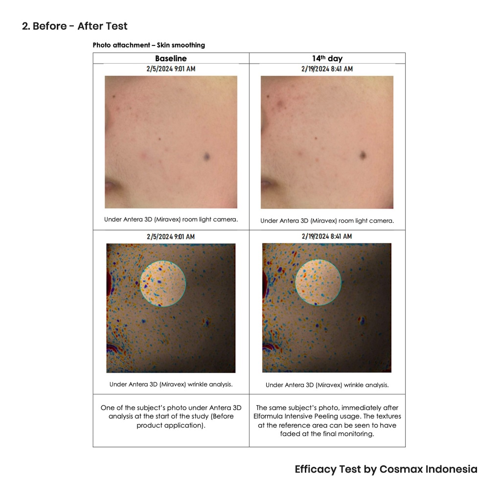 Elformula Intensive Peeling Solution 35gr