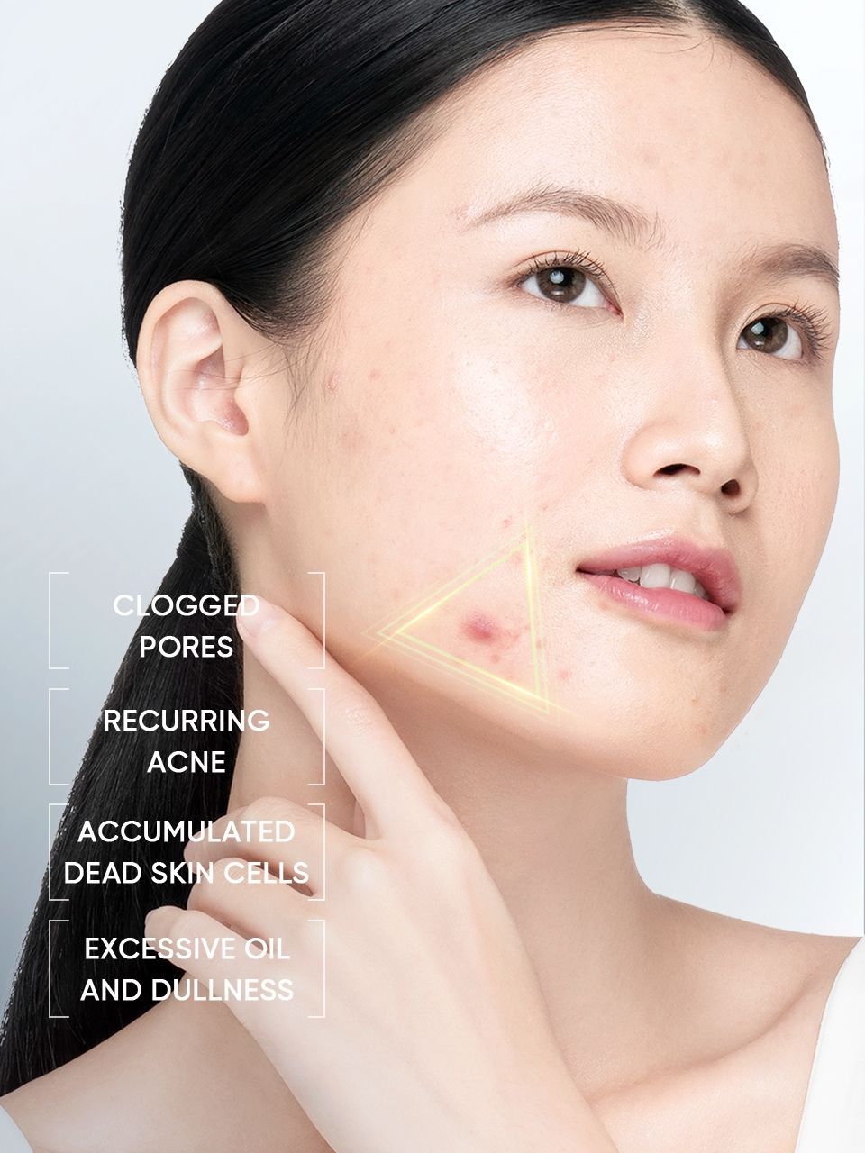 Skintific 3X Acid Anti-Acne Gel Moisturizer 30gr