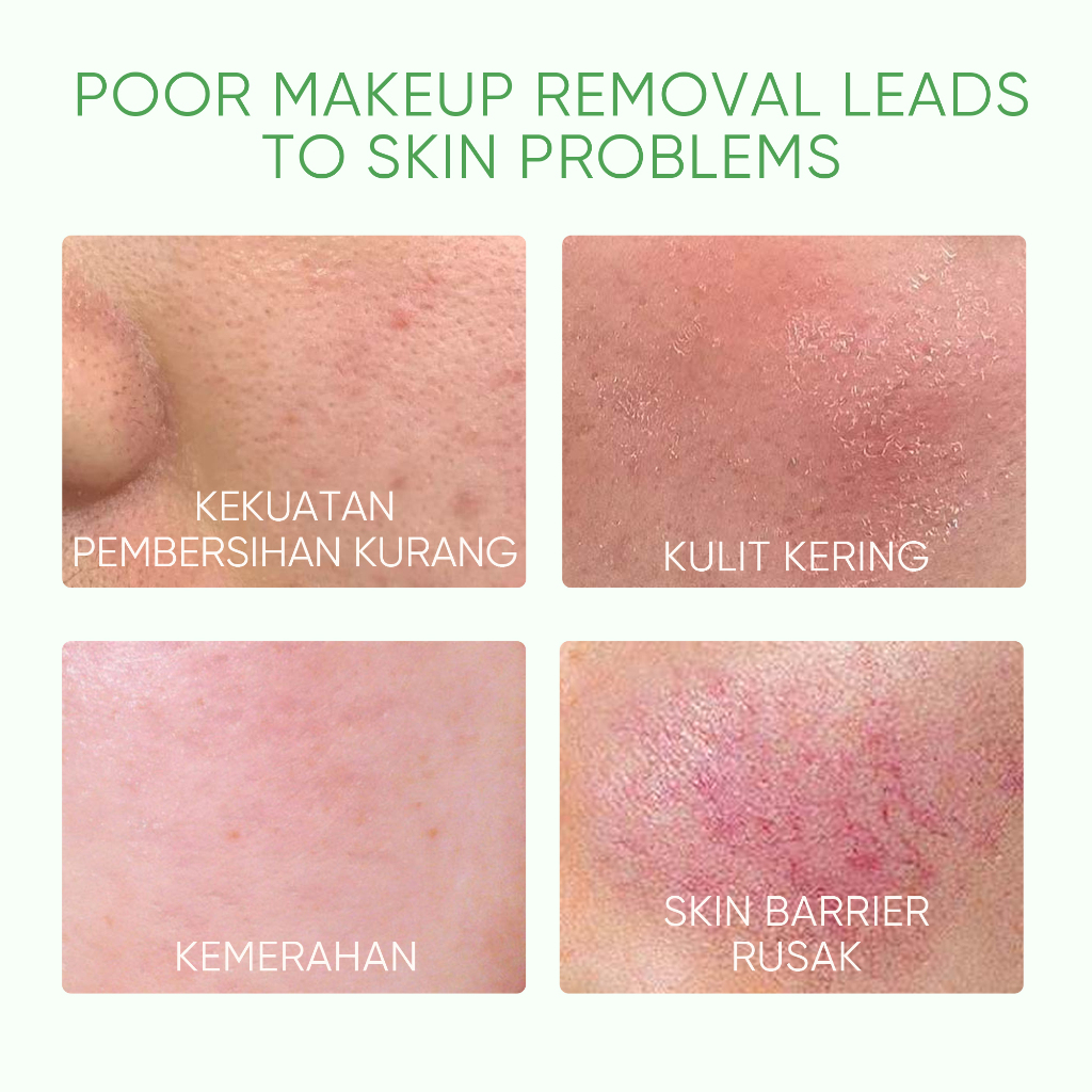 Skintific Mugwort Purifying Micellar Water 75ml (KECIL)