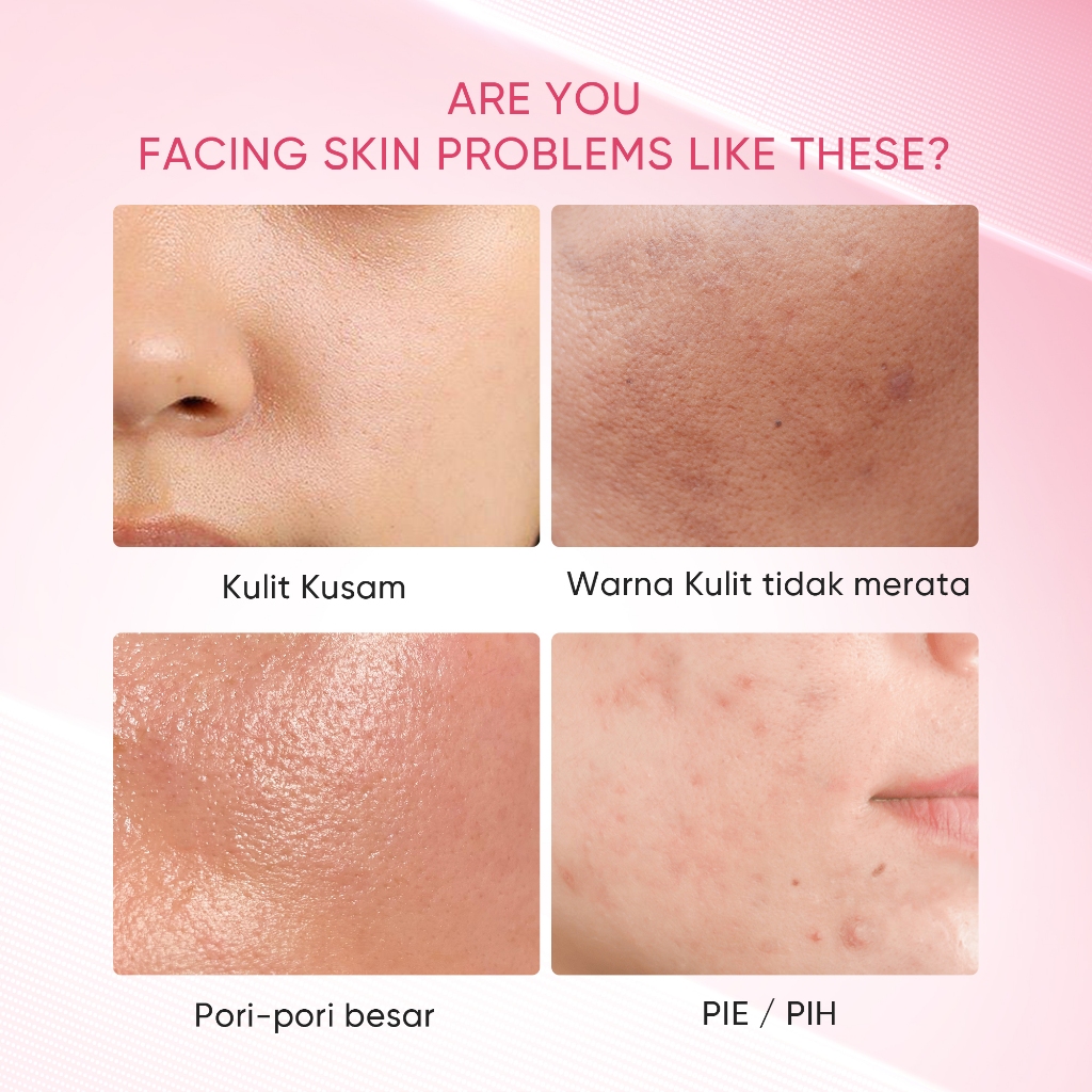 Skintific Niacinamide Bright Boost Clay Stick 40gr