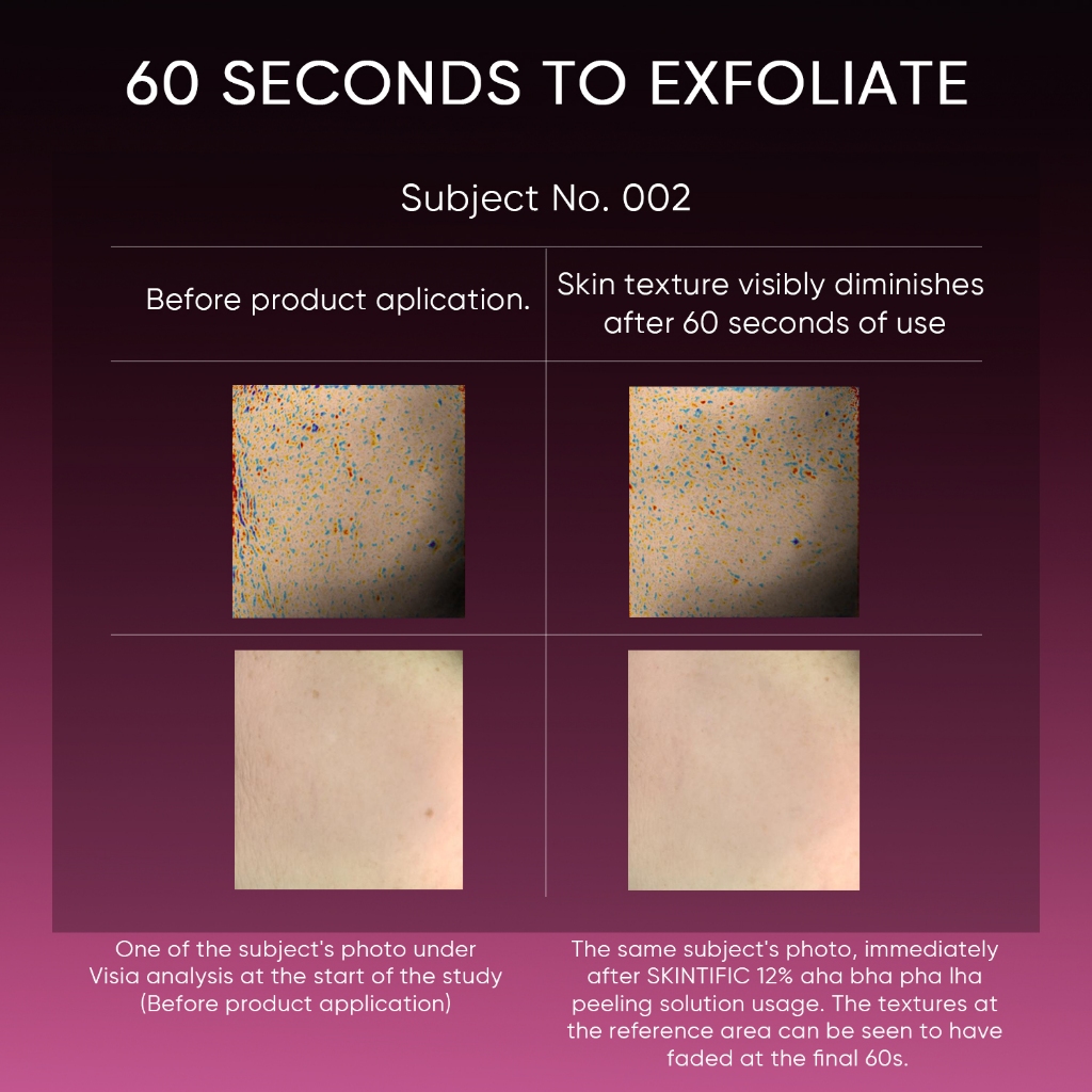 Skintific 12% AHA BHA PHA LHA Peeling Solution Serum 30ml Skintific 12% AHA BHA PHA LHA Peeling Solution Serum 30ml