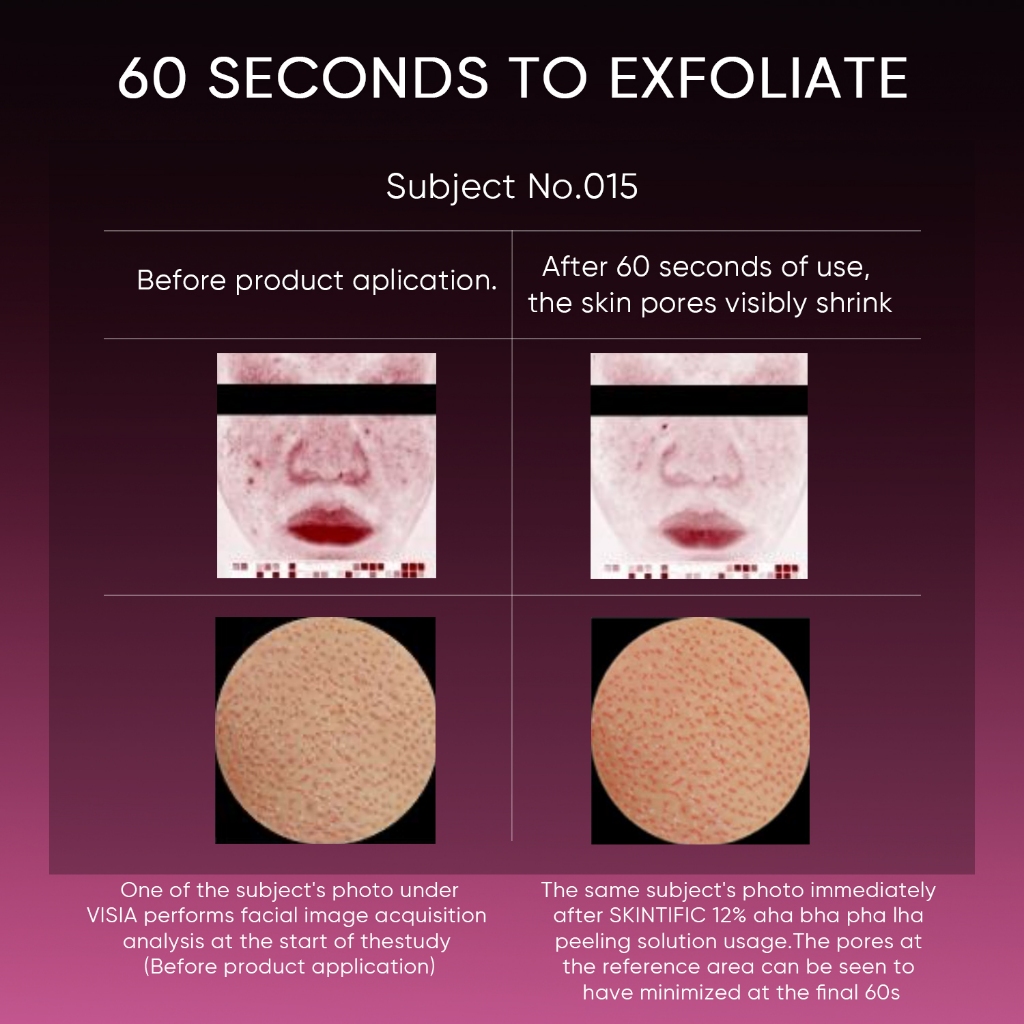 Skintific 12% AHA BHA PHA LHA Peeling Solution Serum 30ml Skintific 12% AHA BHA PHA LHA Peeling Solution Serum 30ml