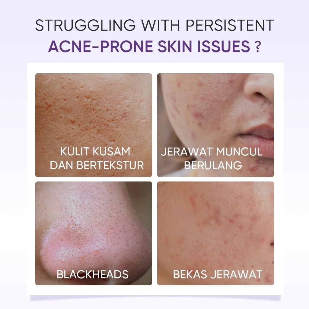 Skintific Lactic Acid Skin Renewal Exfoliating Serum 20ml