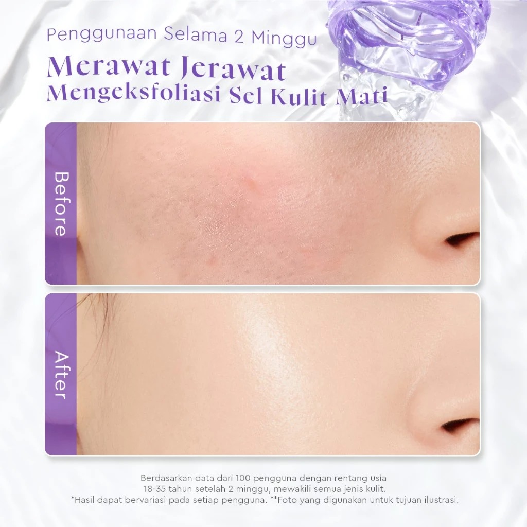 Glad 2 Glow Toner - Blackberry AHA BHA PHA Exfoliating 80ml