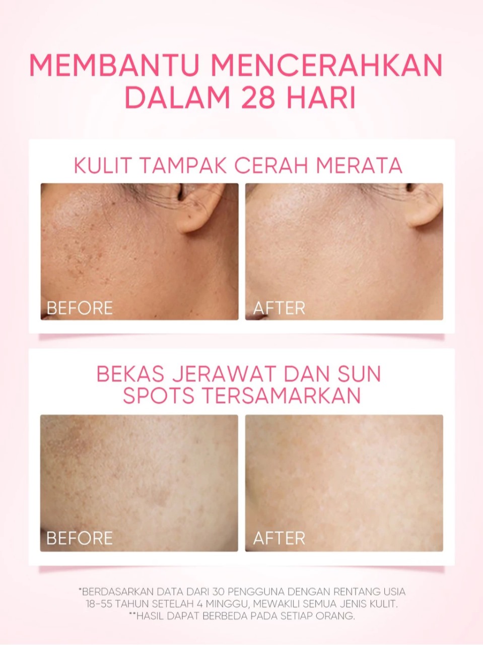 Skintific MSH Niacinamide Brightening Moisturizer 80gr