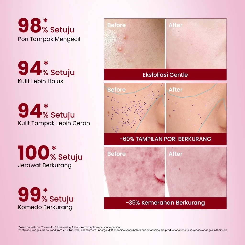 YOU 6% Acid Renewal Peeling Serum 20ml *