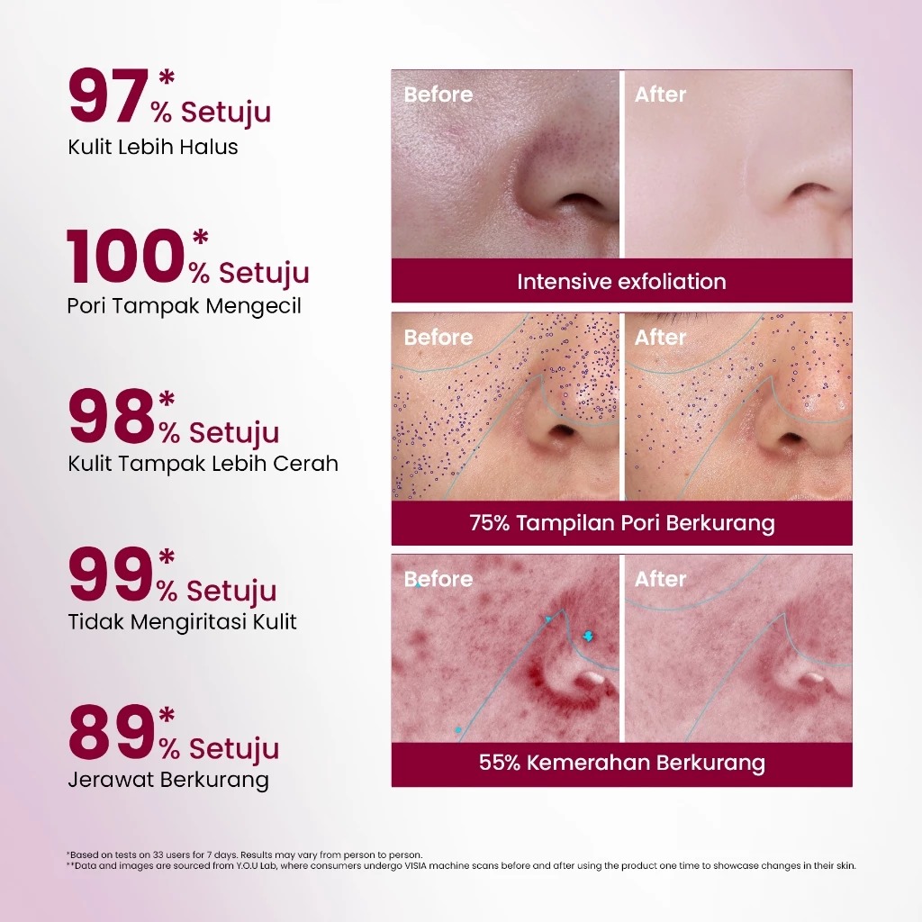 YOU 12% Acid Intensive Peeling Serum 20ml *