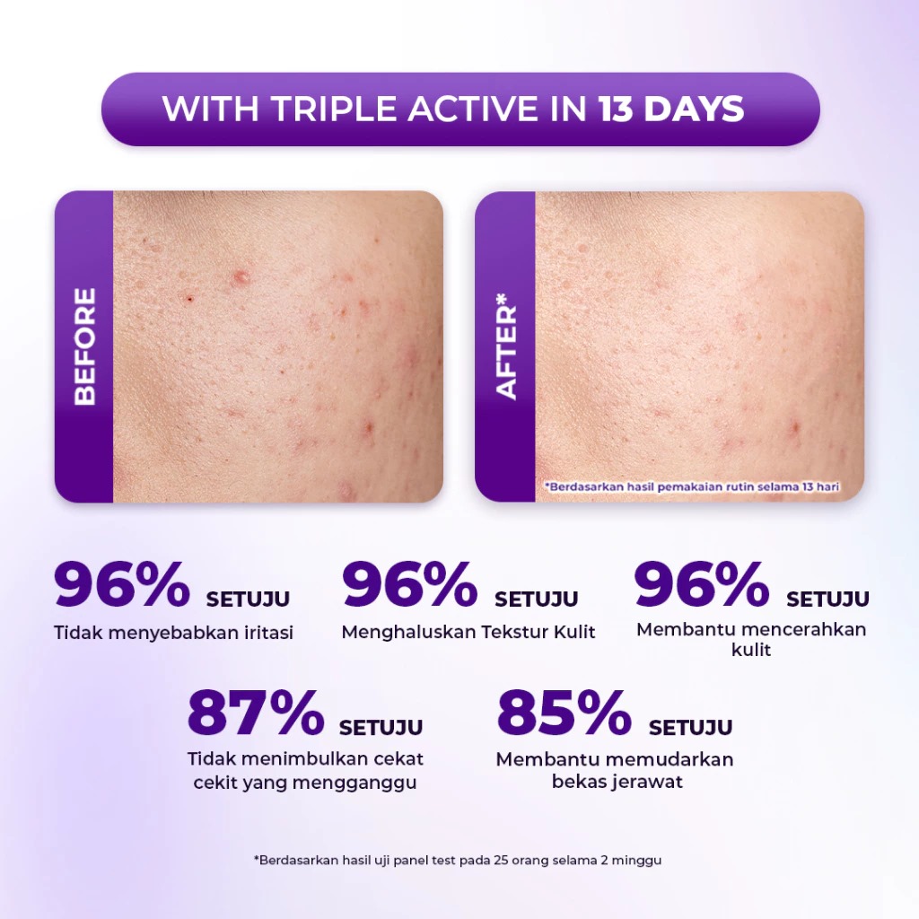 Facetology Triple Care Purple Ranger Peeling Treatment 33ml