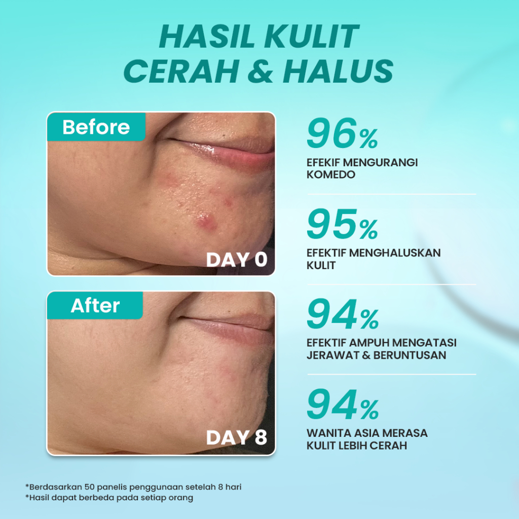 Hanasui Serum Advance Exfoliating Serum 20ml (Tosca)