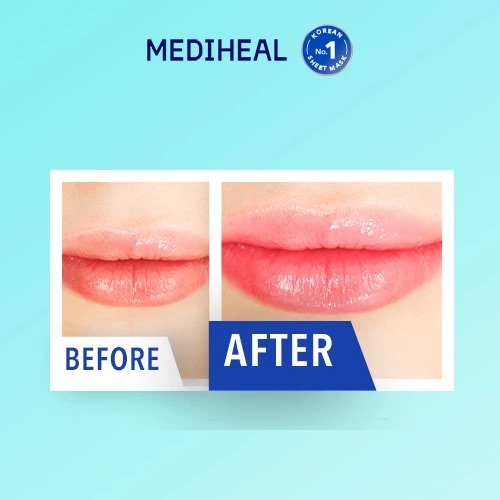 Mediheal Pantenolips Healssence (Lip Essence) 10ml Mediheal Pantenolips Healssence (Lip Essence) 10ml