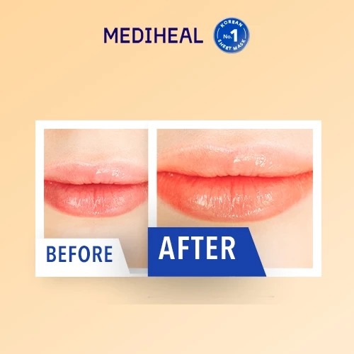 Mediheal Pantenolips Healssence (Lip Essence) 10ml - Coral