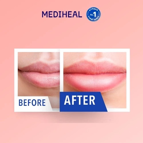 Mediheal Pantenolips Healbalm (Lip Balm) 10ml Mediheal Pantenolips Healbalm (Lip Balm) 10ml