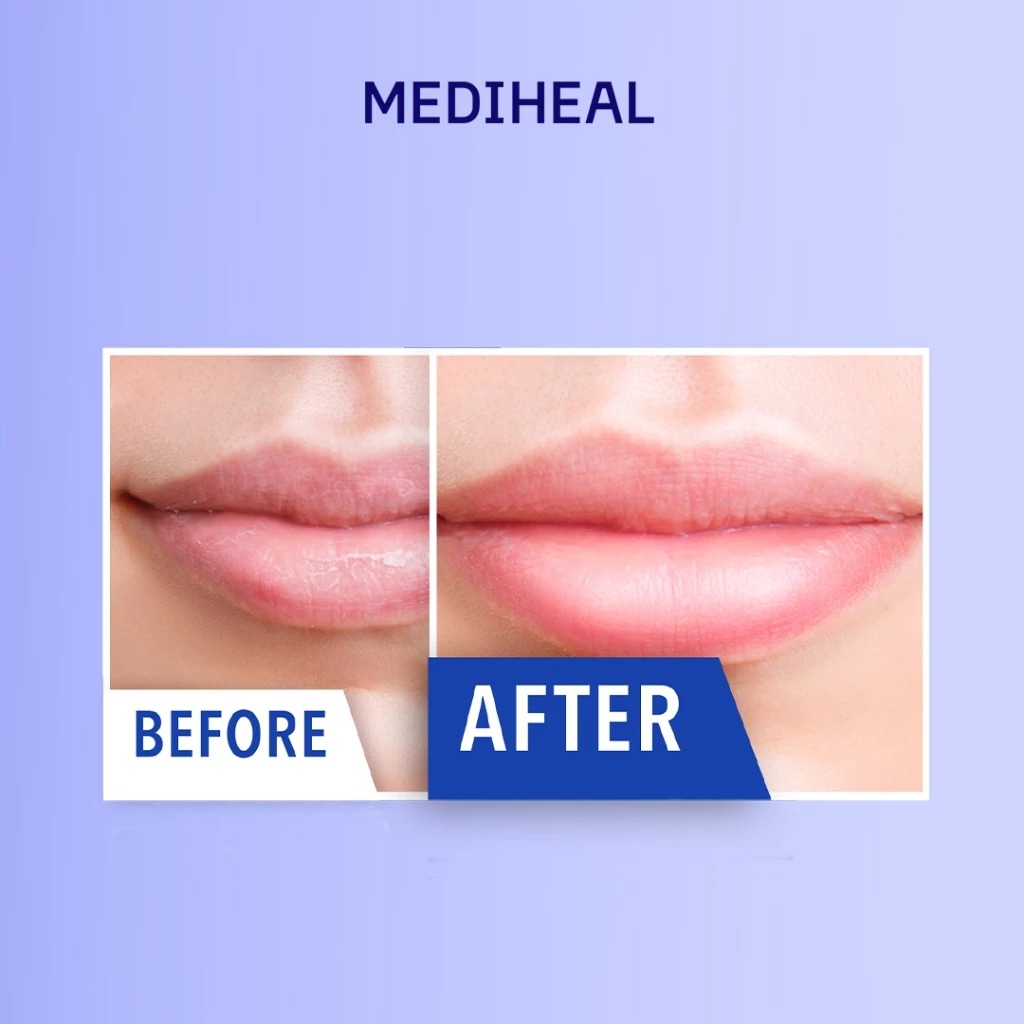 Mediheal Pantenolips Healbalm (Lip Balm) 10ml