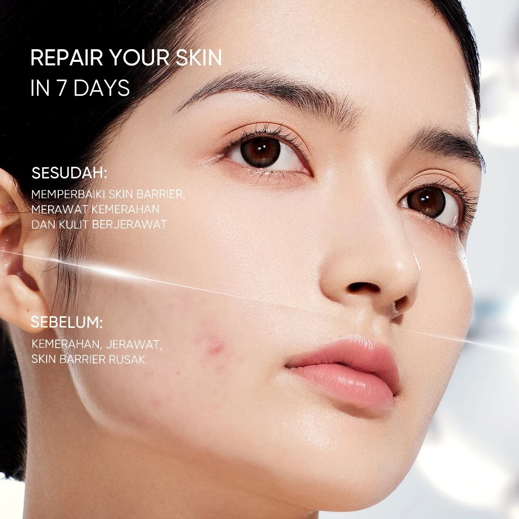 Skintific Sensitive Moisture Gel 40ml - Calm & Repair