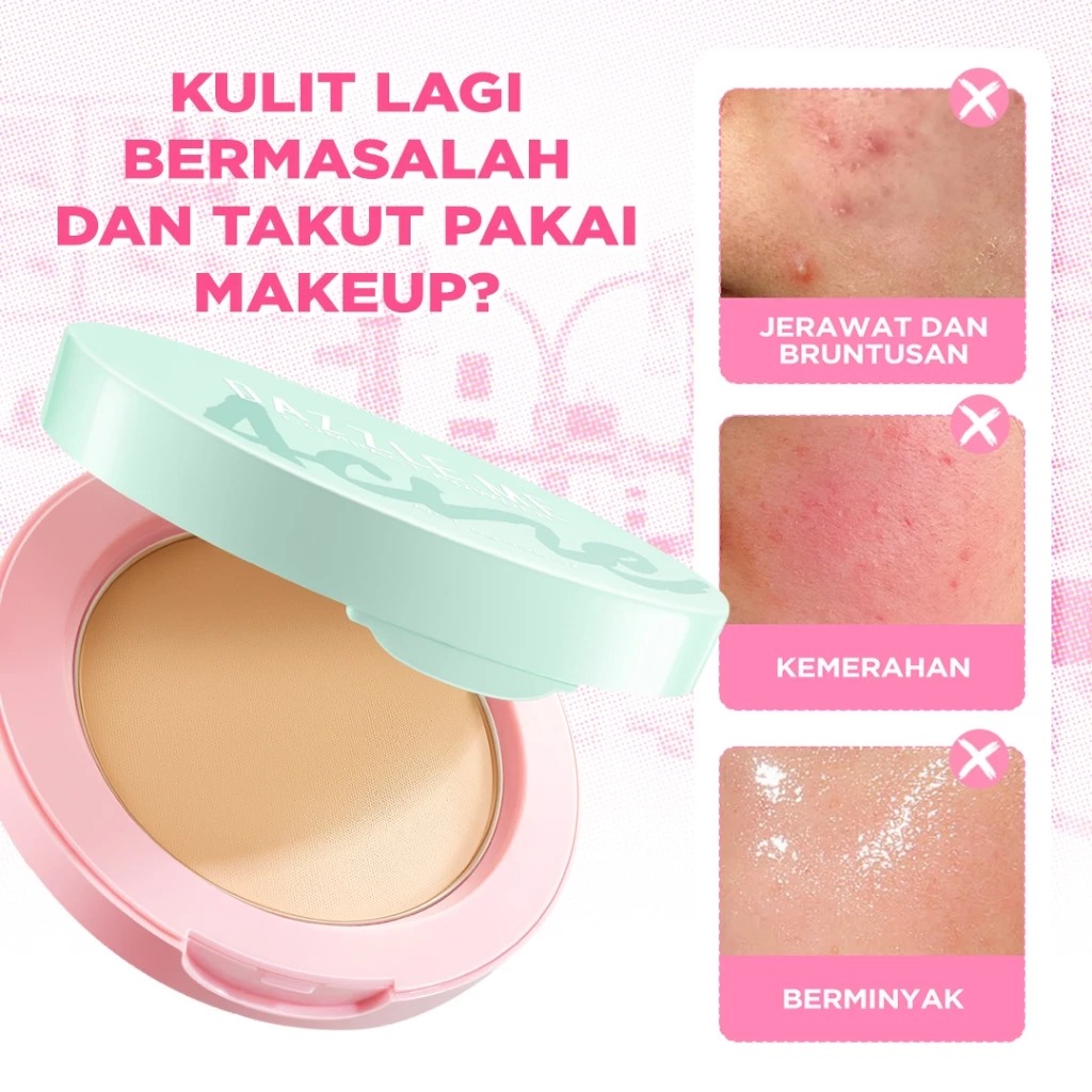 Dazzle Me Acne Armor Compact Powder 8gr - W01 Light Ivory