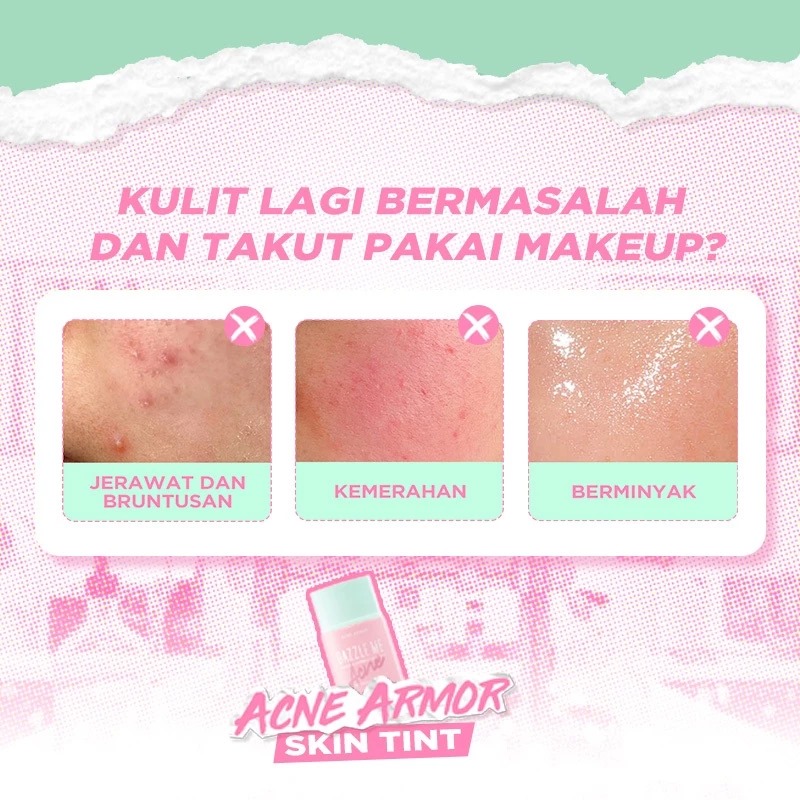 Dazzle Me Acne Armor Cover & Correct Skin Tint 25ml - W01 Light Ivory