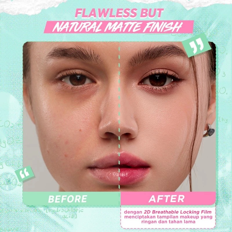 Dazzle Me Acne Armor Cover & Correct Skin Tint 25ml - C05 Medium Pink