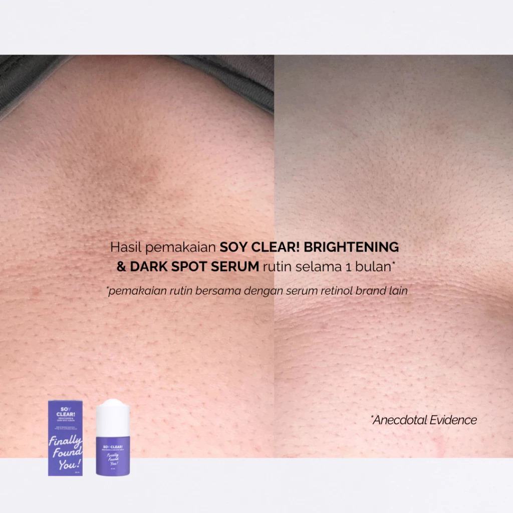 Finally Found You! Soy Clear Brightening & Dark Spot Serum 20ml