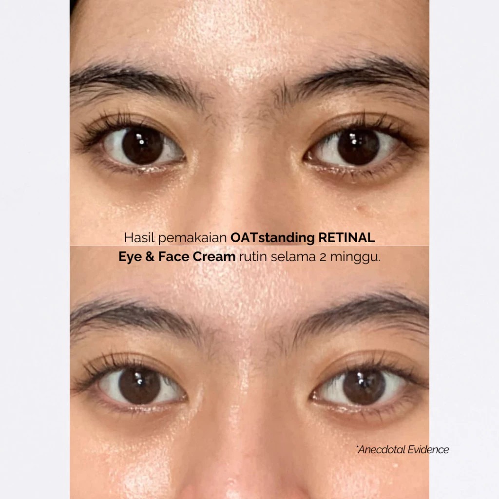 Finally Found You! Outstanding Retinal Eye & Face Cream 20ml