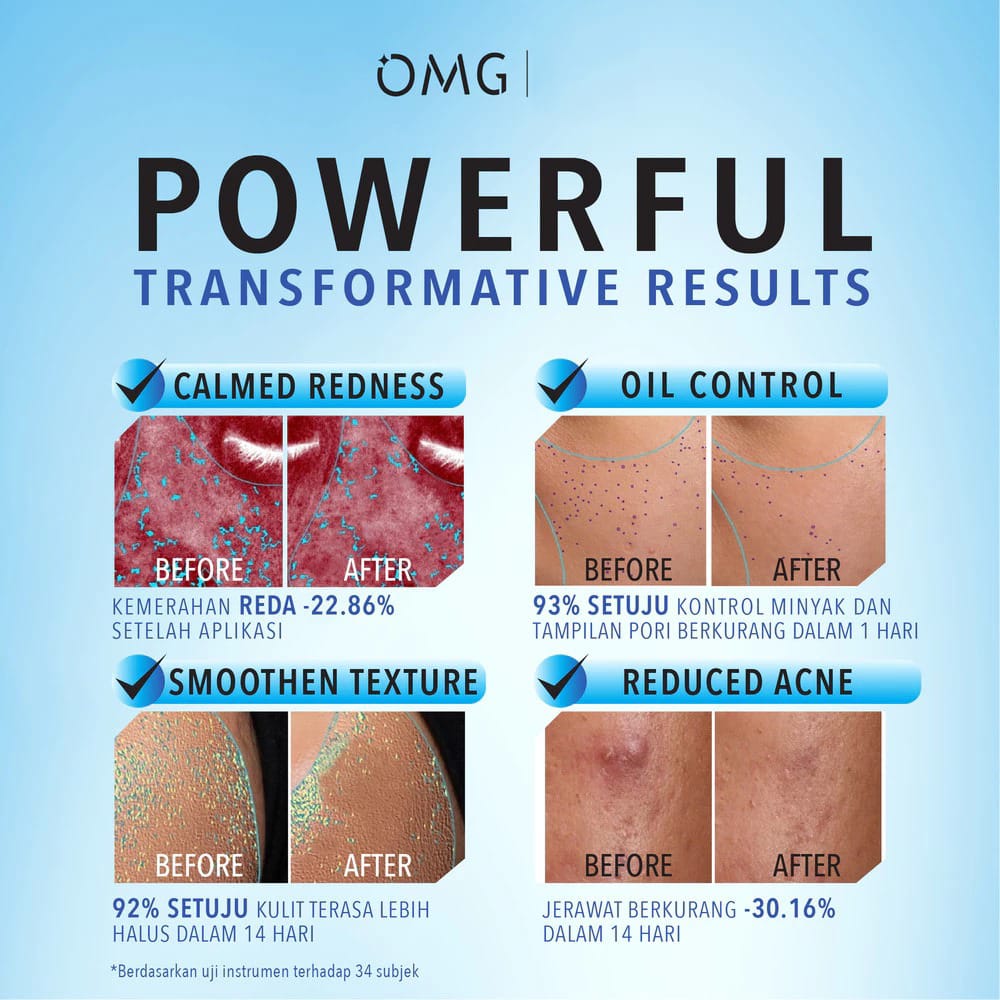 Oh My Glam Moisture Gel 45gr - 2% Cica-B5 Calming (OMG)