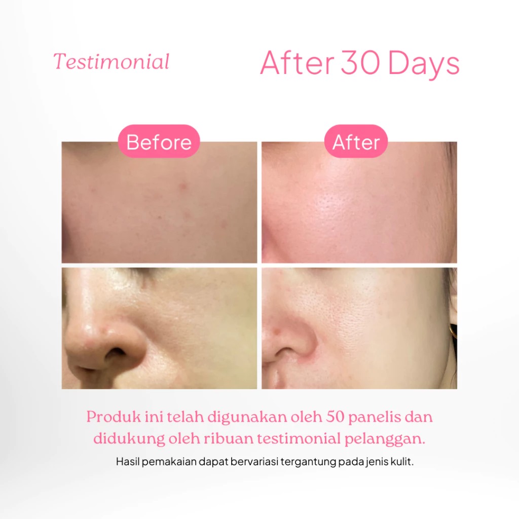 Dorskin Pink Bliss Moisturizer 30gr