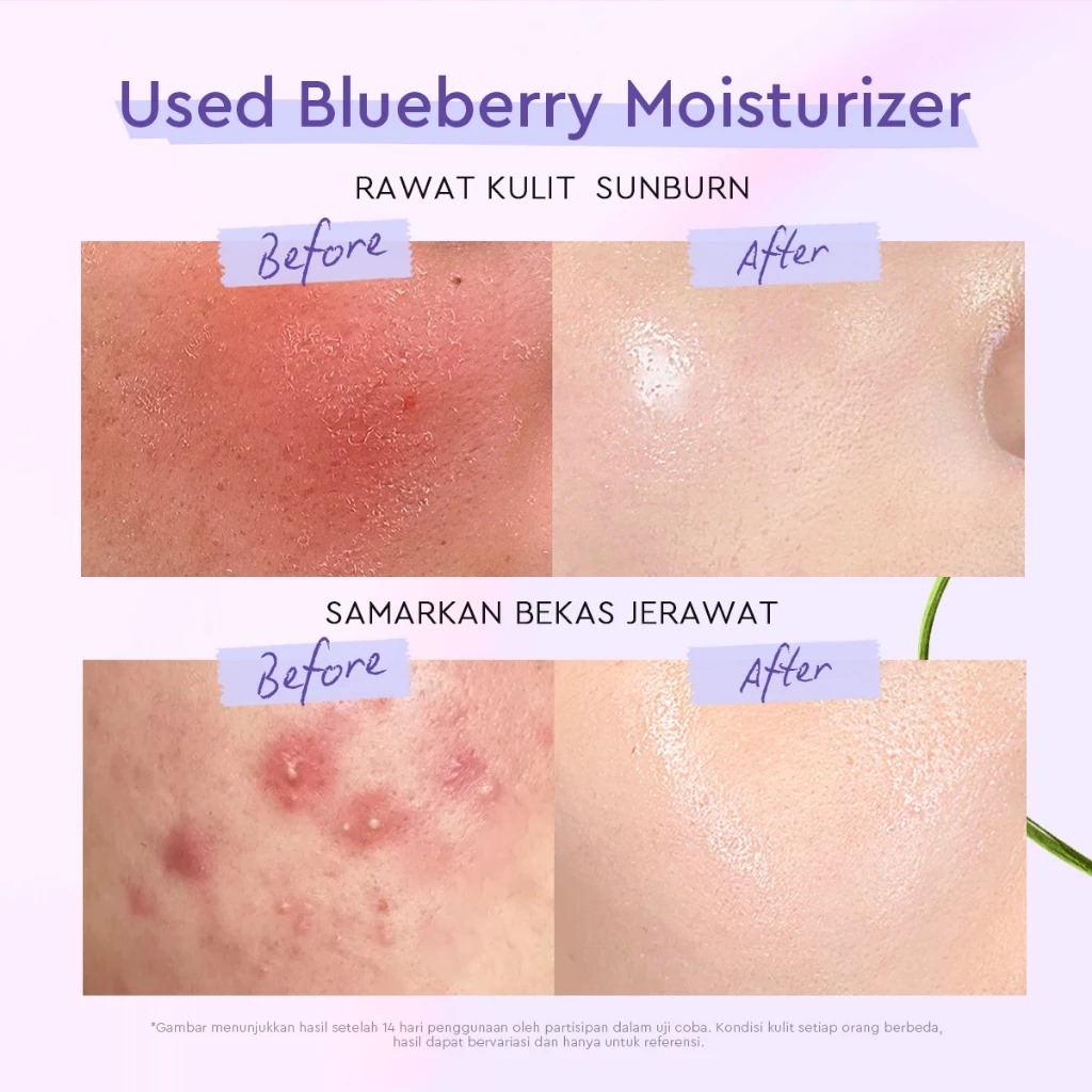 Glad 2 Glow Moisturizer - Blueberry 5% Ceramide 100gr